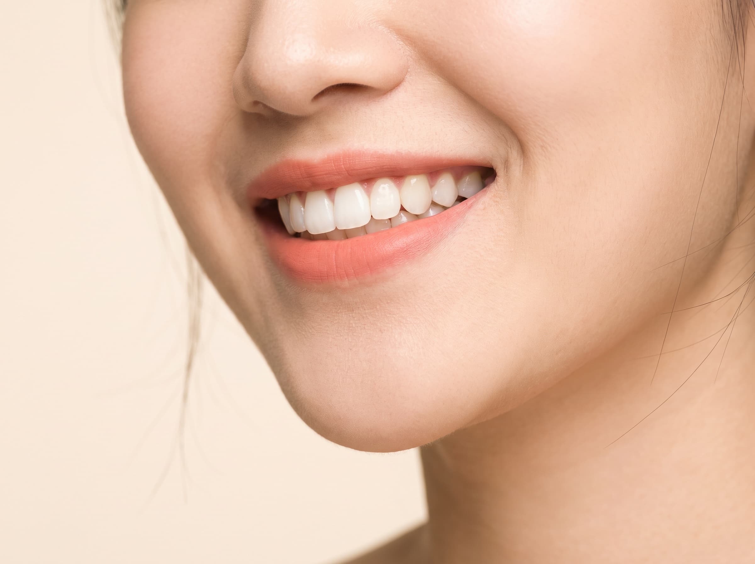 밝고 자연스러운 미소 — 앞니 부분교정 후의 가지런한 치열